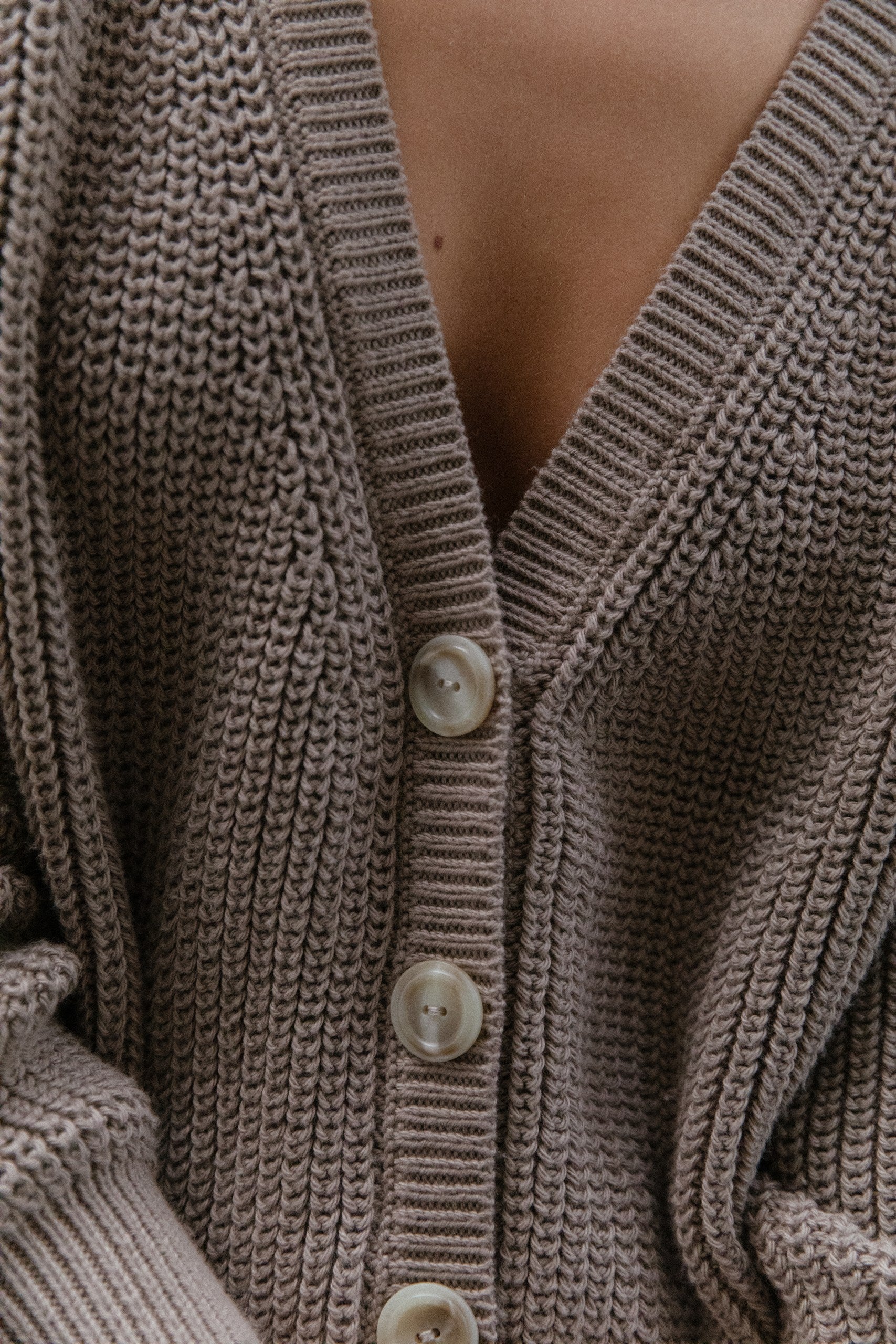 Cardigan Ame · Topo
